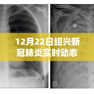 紹興新冠肺炎實時動態(tài)報告（12月22日更新），聚焦最新動態(tài)分析