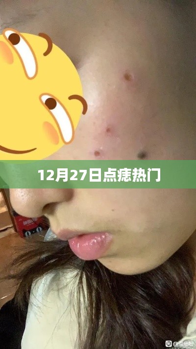 12月27日痣點(diǎn)熱門趨勢(shì)揭秘
