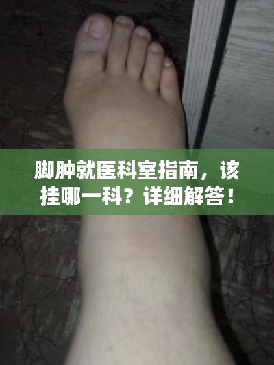 腳腫就醫(yī)科室指南，該掛哪一科？詳細(xì)解答！