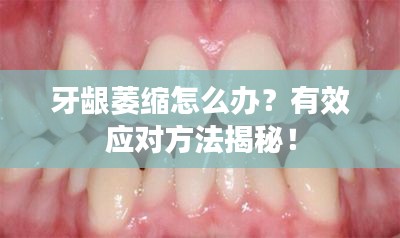 牙齦萎縮怎么辦？有效應(yīng)對方法揭秘！