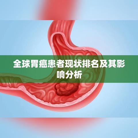 全球胃癌患者現(xiàn)狀排名及其影響分析