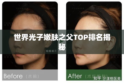 世界光子嫩膚之父TOP排名揭秘
