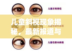 兒童斜視現(xiàn)象揭秘，最新報(bào)道與深度解析
