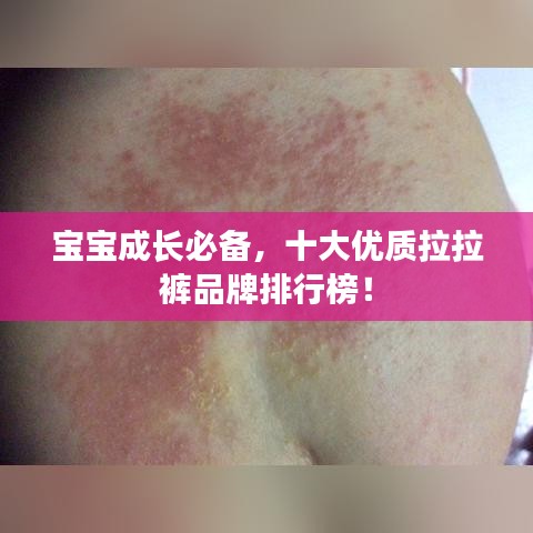 集腋成裘