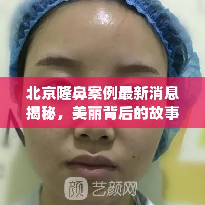 北京隆鼻案例最新消息揭秘，美麗背后的故事！