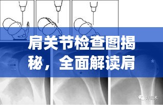 肩關節(jié)檢查圖揭秘，全面解讀肩關節(jié)健康與功能狀態(tài)