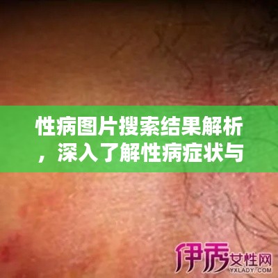 性病圖片搜索結(jié)果解析，深入了解性病癥狀與防治知識